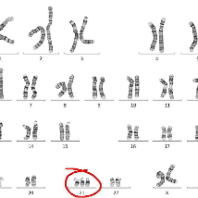 Chromosomes