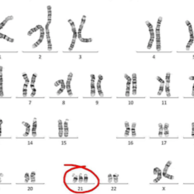 Chromosomes explained on a diagram