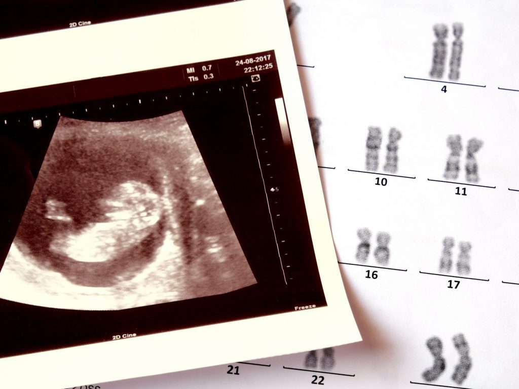 Prenatal Screening thumbnail.