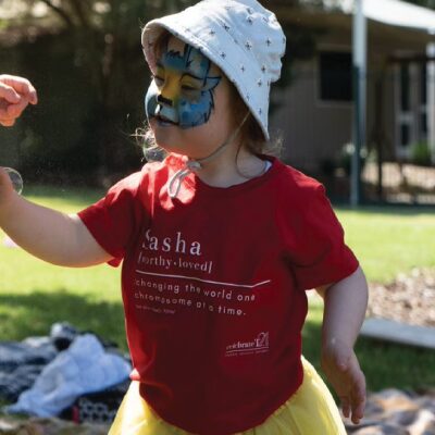 Support Down Syndrome Queensland thumbnail.